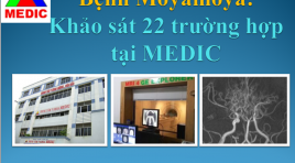 Bệnh Moyamoya: khảo sát 22 trường hợp tại Medic