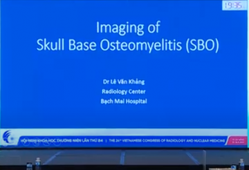 Imaging of skull base osteomyelitis 