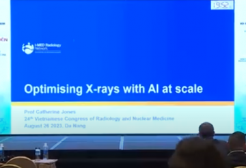 Optimizing AI implementation in X-rays with large scale
